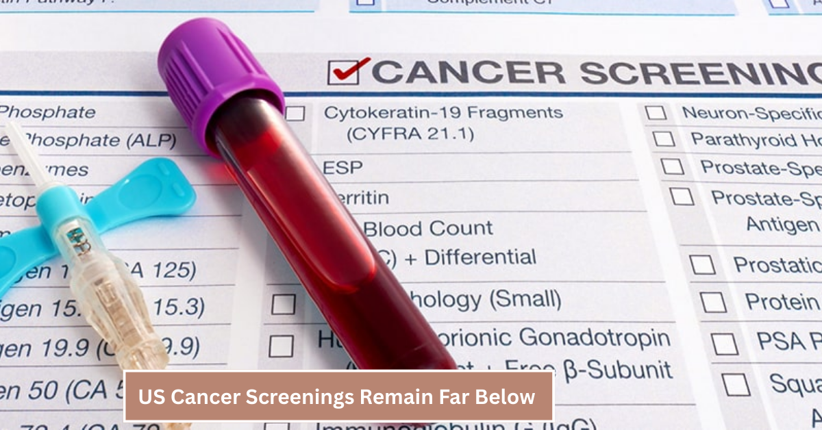 US Cancer Screenings Remain Far Below