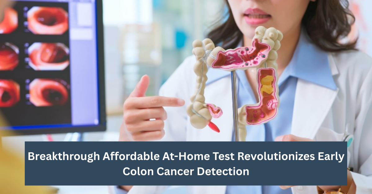 Breakthrough Affordable At-Home Test Revolutionizes Early Colon Cancer Detection