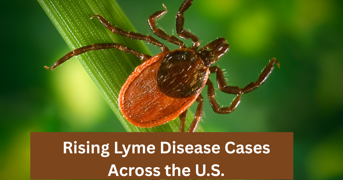 Rising Lyme Disease Cases Across the U.S.: What You Need to Know to Stay Protected Now